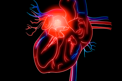 Онкология сердца