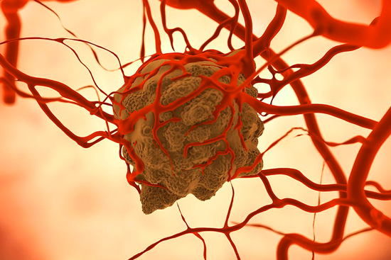 Взрослые могут использовать тест НМО для выявления кишечной ангиодисплазии