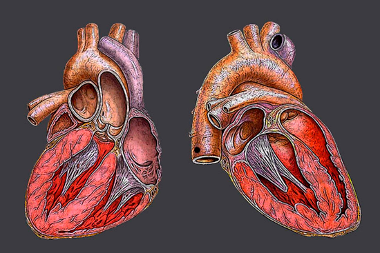 Дилатационная кардиомиопатия: причины, симптомы, диагностика и терапия