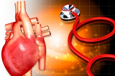 Методы лечения ишемической болезни сердца